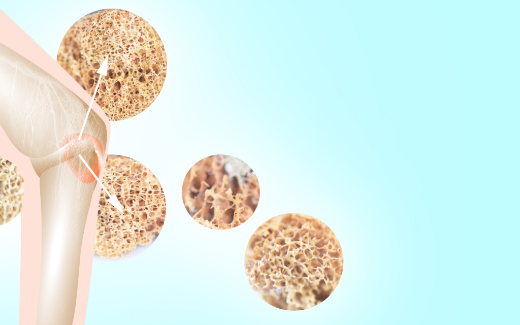 The science of building stronger bones